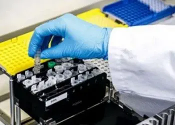 Maluku Kekurangan Laboratorium Uji Spesimen PCR
