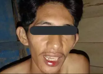 Seorang Mahasiswa Dianiaya Anggota Polisi di Halmahera Utara