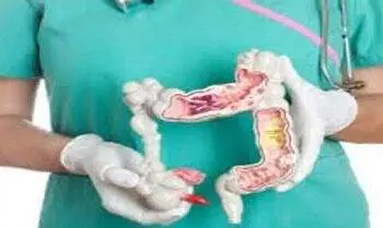 Usus