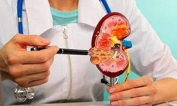 ilustrasi ginjal 169